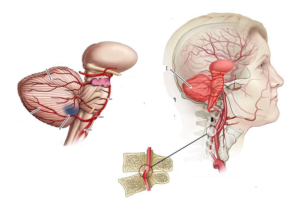 Cerebelar
